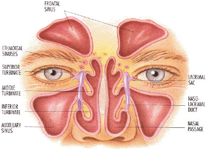 Medical Overview of Sinusitis