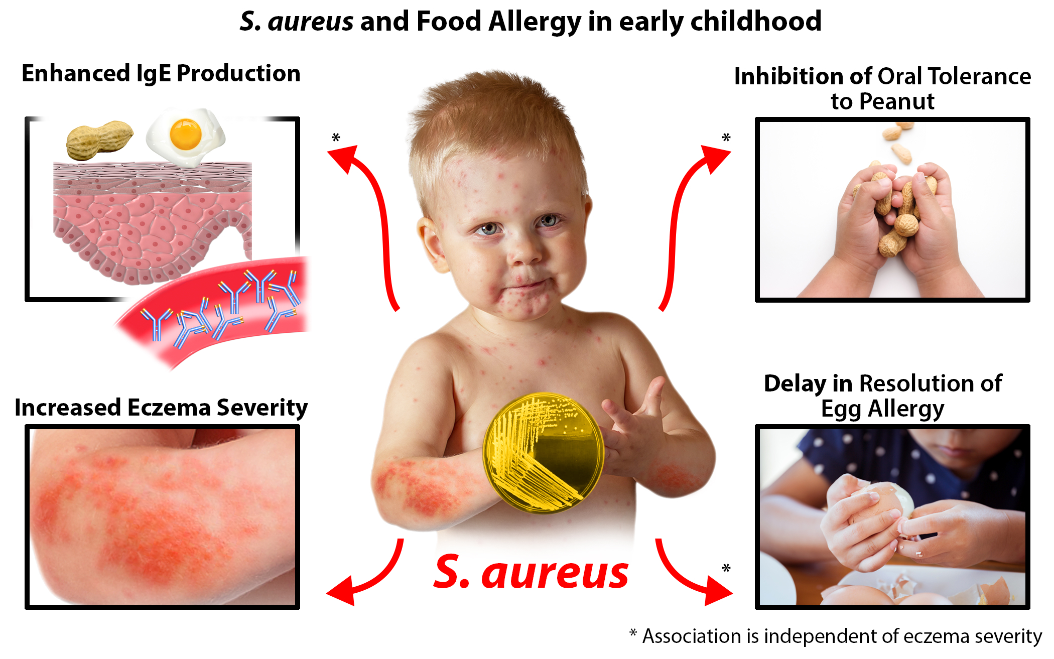 allergy eczema new research