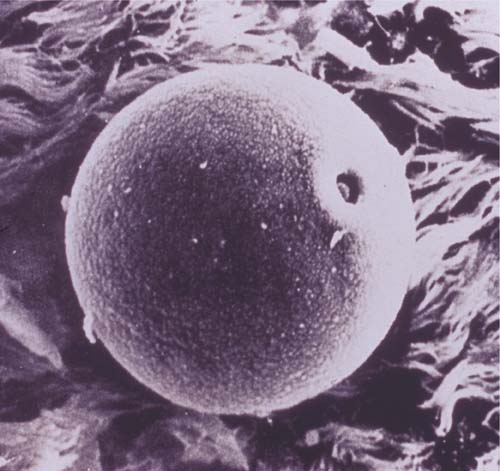 Grass Pollen