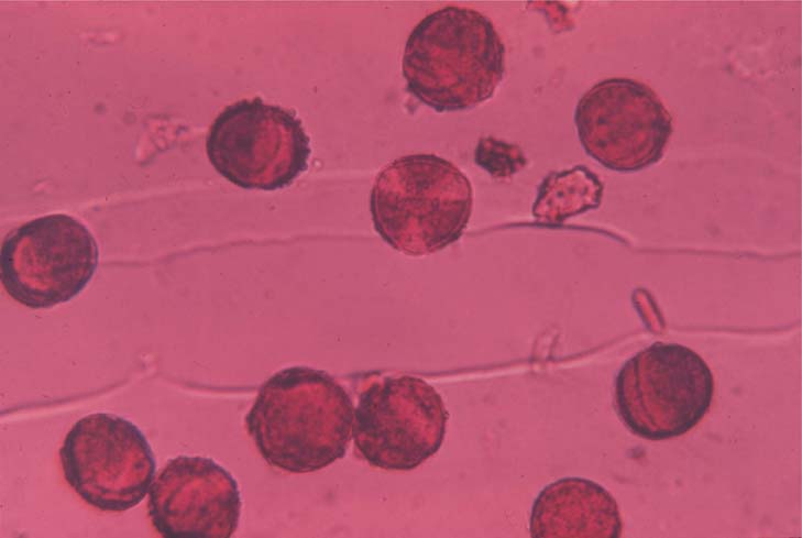 Maple Pollen
