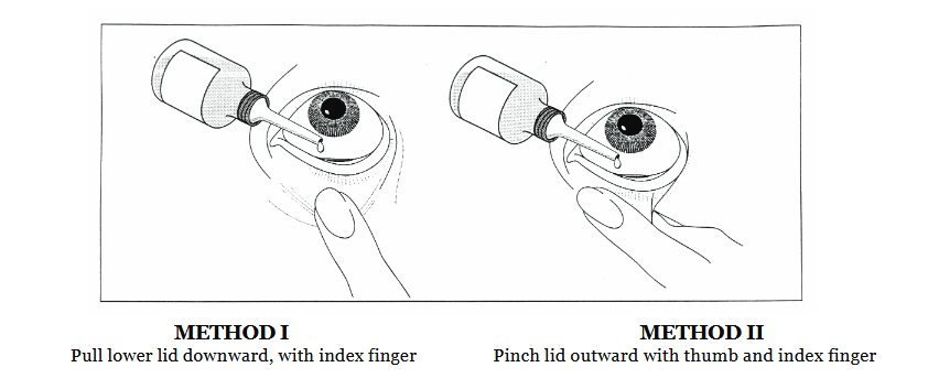 eye allergy