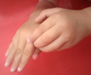 Afecciones de alergia cutánea Consejos para tener en cuenta